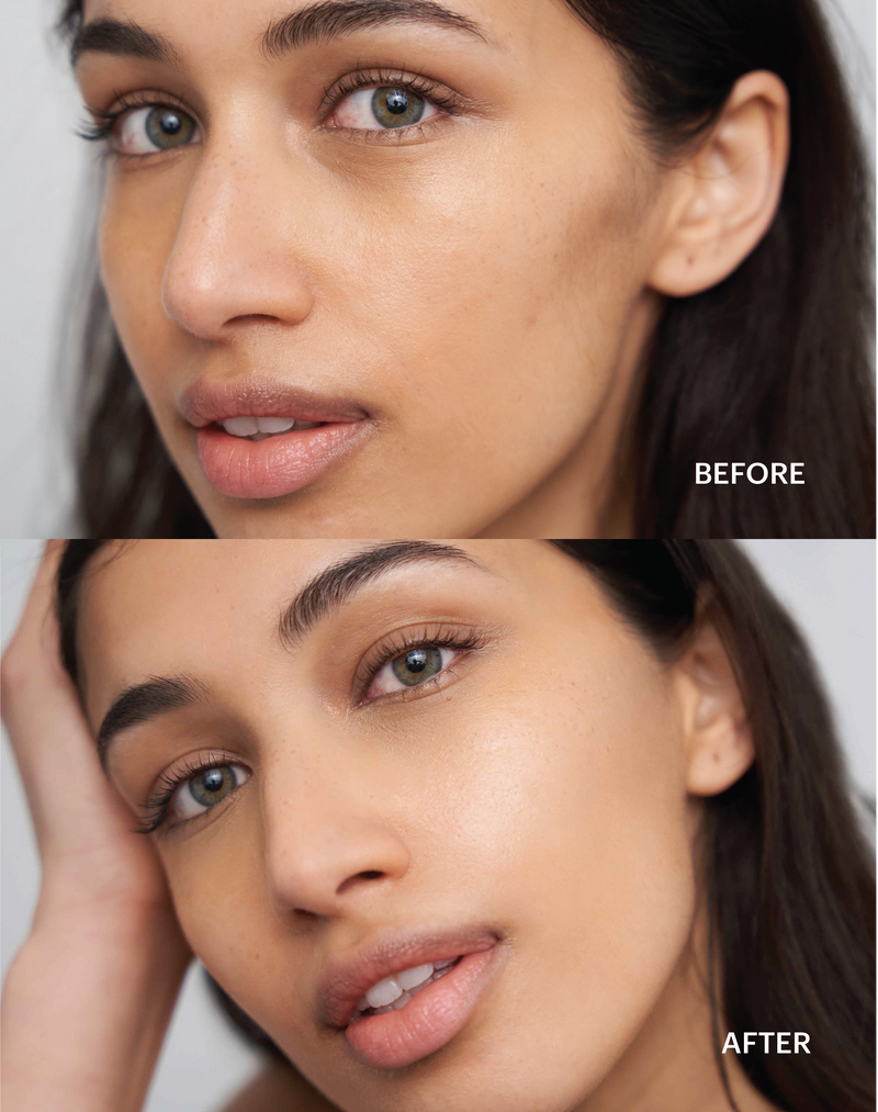 medium; Yashvi Before - After