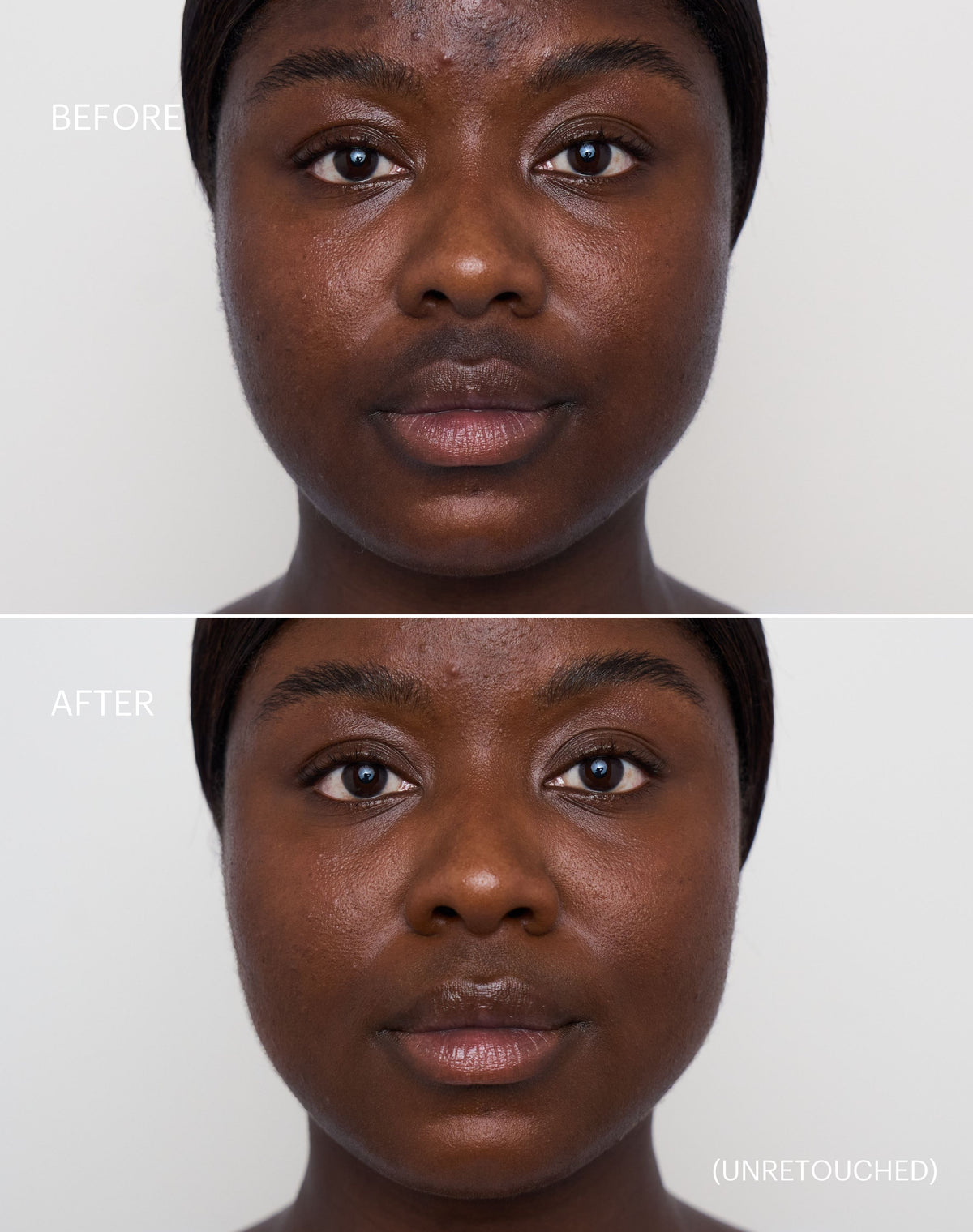 concealer-stick-spf-20; deep-1: Before & after of shade Deep 1