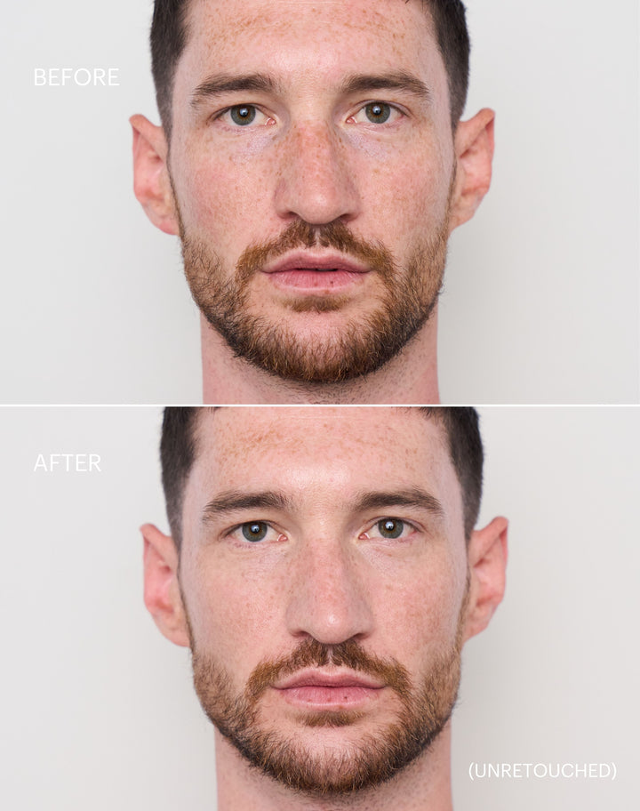 concealer-stick-spf-20; light-to-medium: Before & after of shade Light to Medium