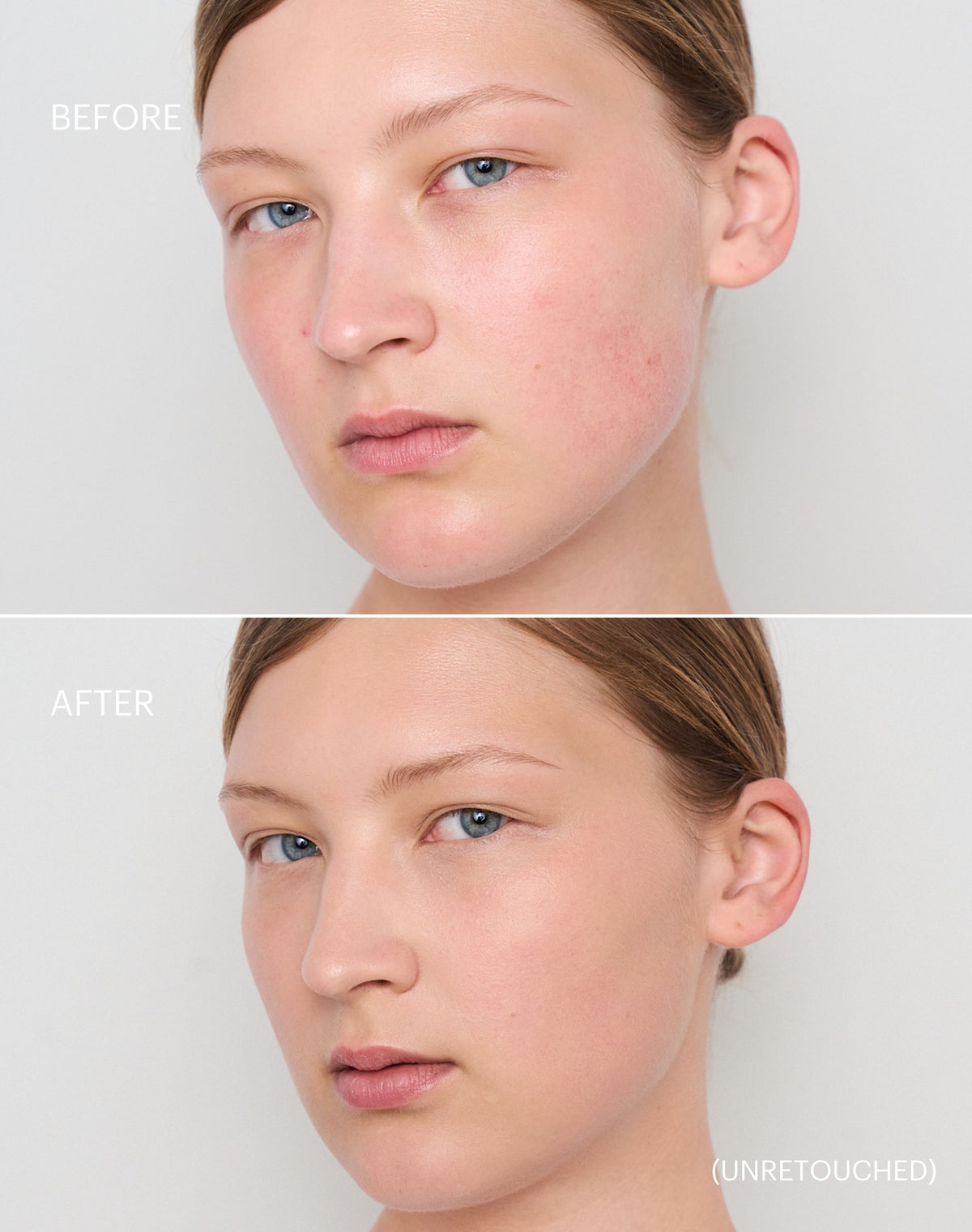 concealer-stick-spf-20; light-to-medium: Before & after of shade Light to Medium