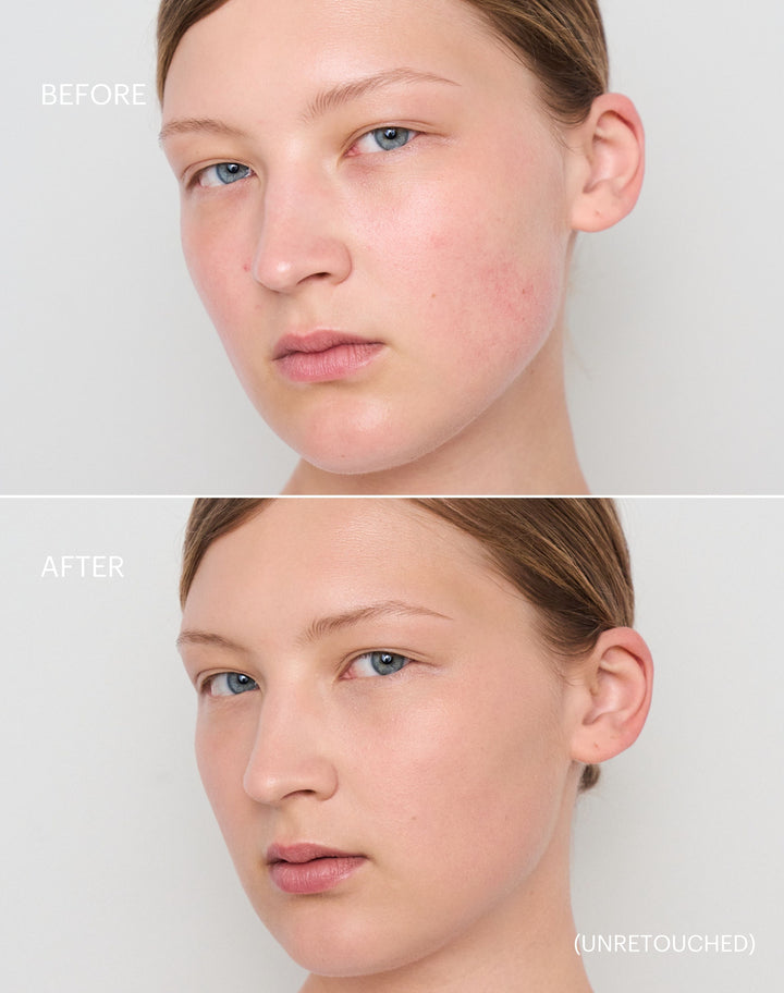 concealer-stick-spf-20; light-to-medium: Before & after of shade Light to Medium