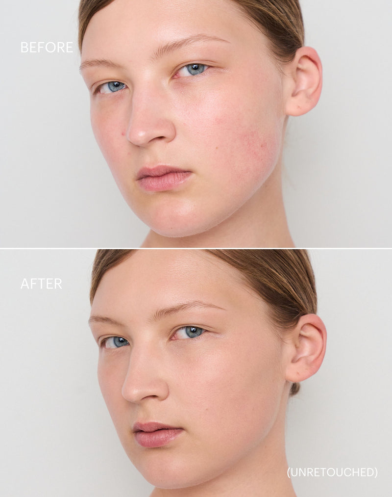 light-to-medium; Before & after of shade Light to Medium