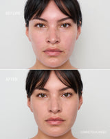 medium-1; Before & after of shade Medium 1