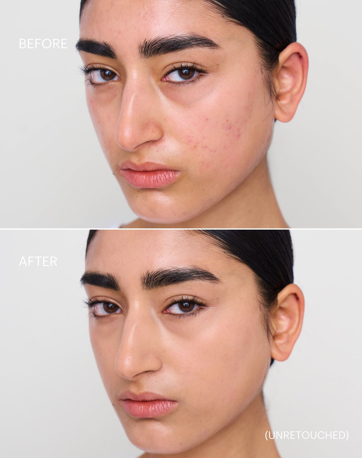 concealer-stick-spf-20; medium-2: Before & after of shade Medium 2