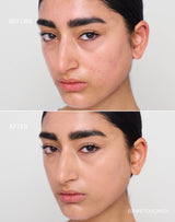 medium-2; Before & after of shade Medium 2