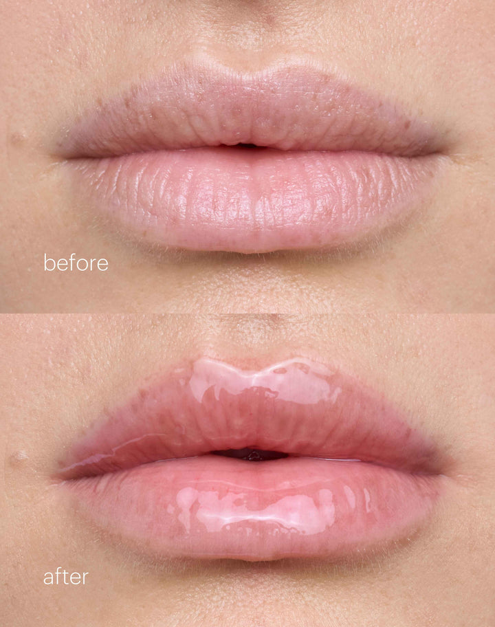 jelly-treat-lip-oil; slip: Before & After Jelly Treat Lip Oil in Slip